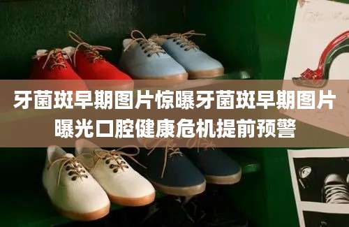 牙菌斑早期图片惊曝牙菌斑早期图片曝光口腔健康危机提前预警