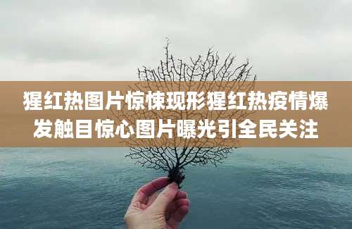 猩红热图片惊悚现形猩红热疫情爆发触目惊心图片曝光引全民关注